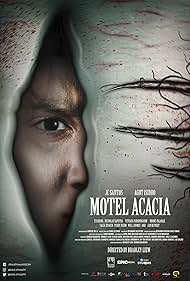 Motel Acacia watch-Motel Acacia