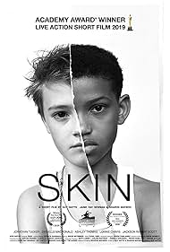Skin watch-Skin