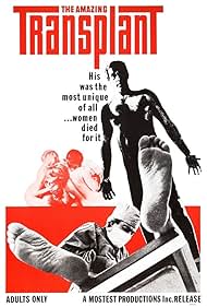 The Amazing Transplant watch-The Amazing Transplant
