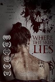 Where the Skin Lies watch-Where the Skin Lies