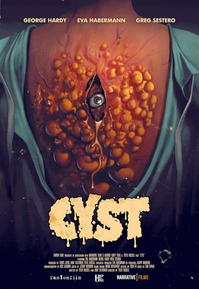 watch-Cyst