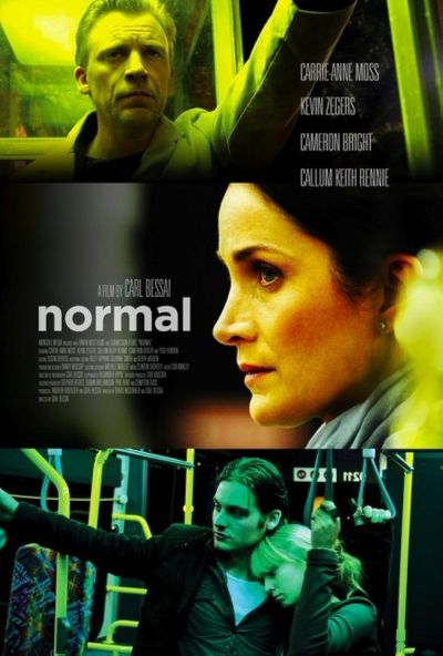 watch-Normal