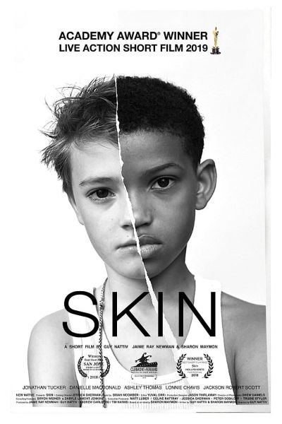 watch-Skin