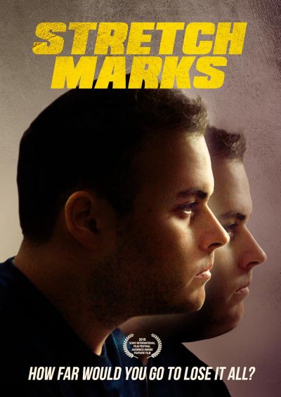 watch-Stretch Marks