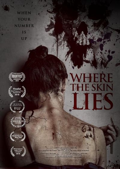 watch-Where the Skin Lies